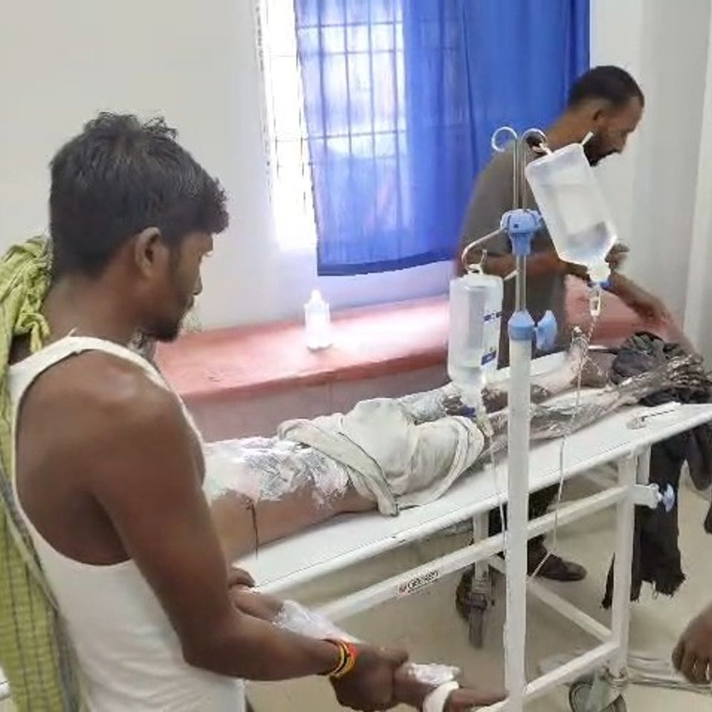 हाईटेंशन तार की चपेट में मजदूर गंभीर रूप से झुलसा:झाझा स्टेशन पर फुट ओवरब्रिज रंगाई के दौरान हादसा, 80 प्रतिशत जला