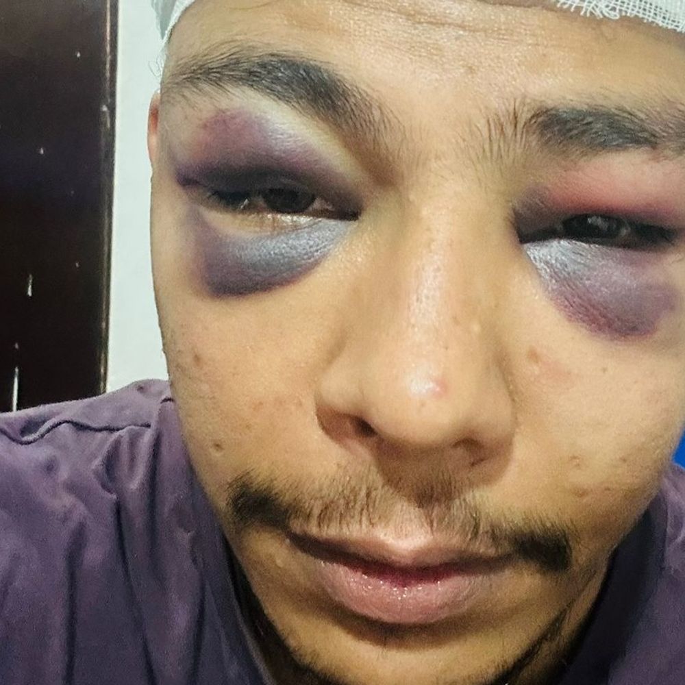 गुरुग्राम में भाषा को लेकर बिहार के युवक की पिटाई:  दोस्त के फ्लैट पर कॉमन फ्रेंड ने अधमरा किया, एमएनसी में जॉब करता है – gurugram News