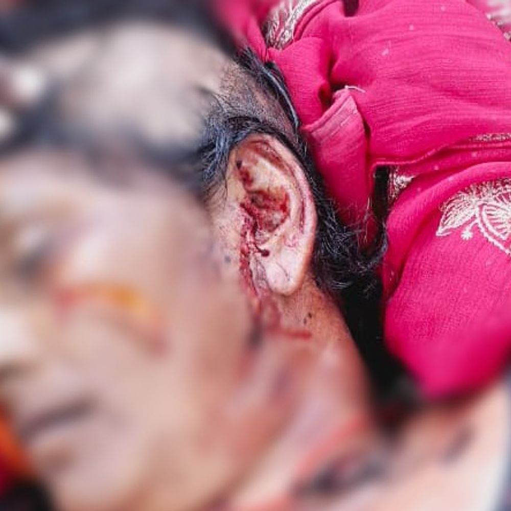 बहराइच में बाघ के हमले में महिला की मौत:  घास काटने के लिए खेत जा रही थी, चीख सुनकर ग्रामीण पहुंचे तो जंगल में भागा बाघा – Bahraich News