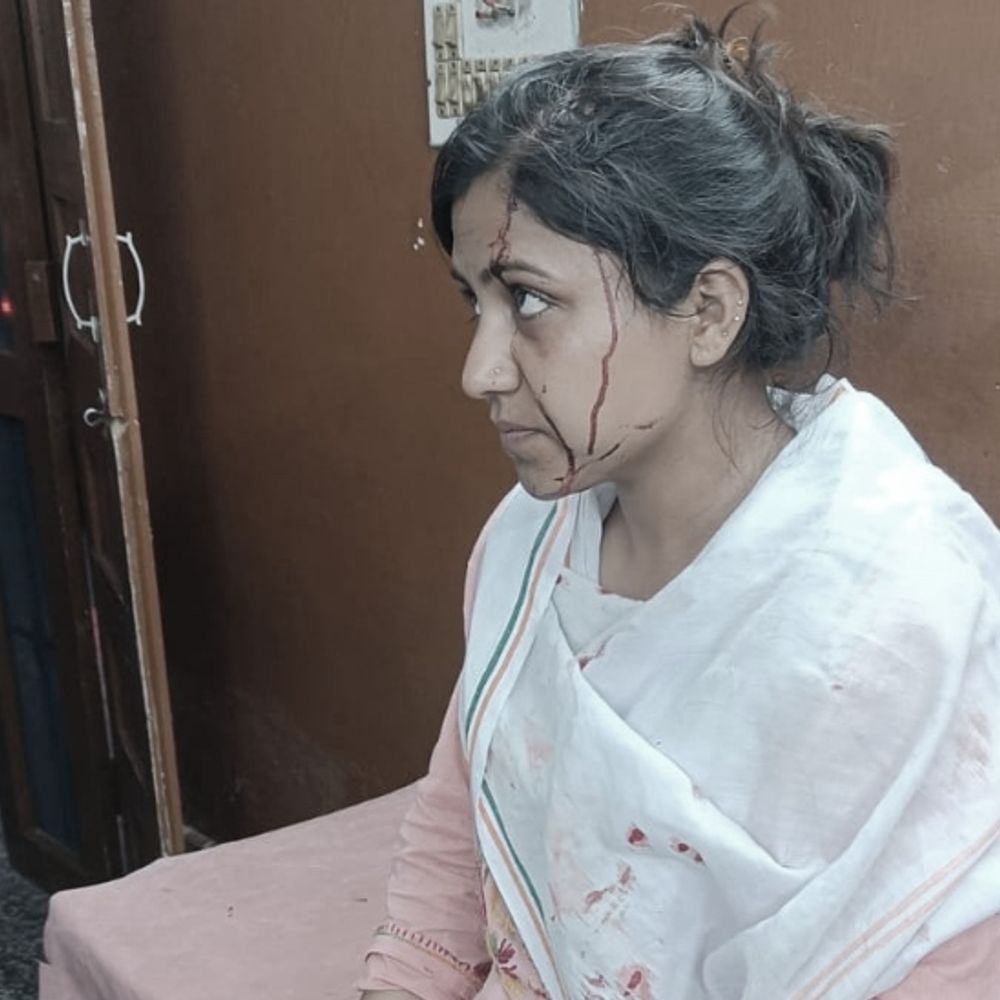 मंडी में जिला परिषद प्रत्याशी पर हमला:  अभिलाषा ठाकुर घायल, कार भी तोड़ी; मां बोलीं- चाकू से वार और पत्थरबाजी की – Mandi (Himachal Pradesh) News