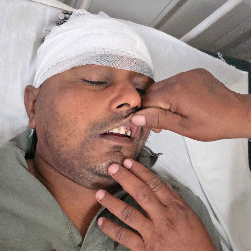 अबोहर चुनाव में दो जगह बवाल:  जाली वोटिंग को लेकर पथराव, फल व्यापारी पर हमला; महिला समेत 5 लोग घायल – Abohar News