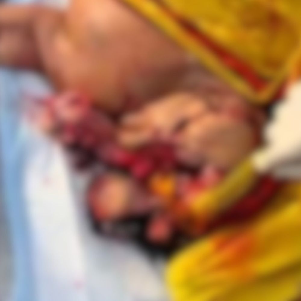 हिट एंड रन में बुजुर्ग महिला की उड़े चिथड़े:  सुबह में पूजा के लिए फूल तोड़ने निकली थी, श्रावस्ती पुलिस ने खुरचकर इकट्ठा किया शव के अवशेष – Ikauna News