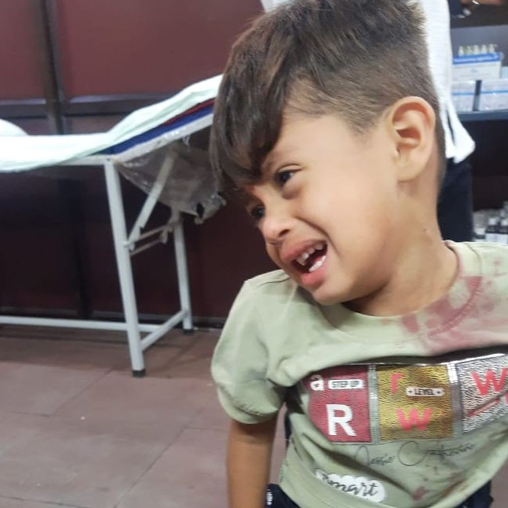ताजमहल घूमने आए बच्चे की कटी जीभ:मुख्य गुंबद के पास फिसल था मासूम का पैर, उपचार के लिए भेजा गया अस्पताल