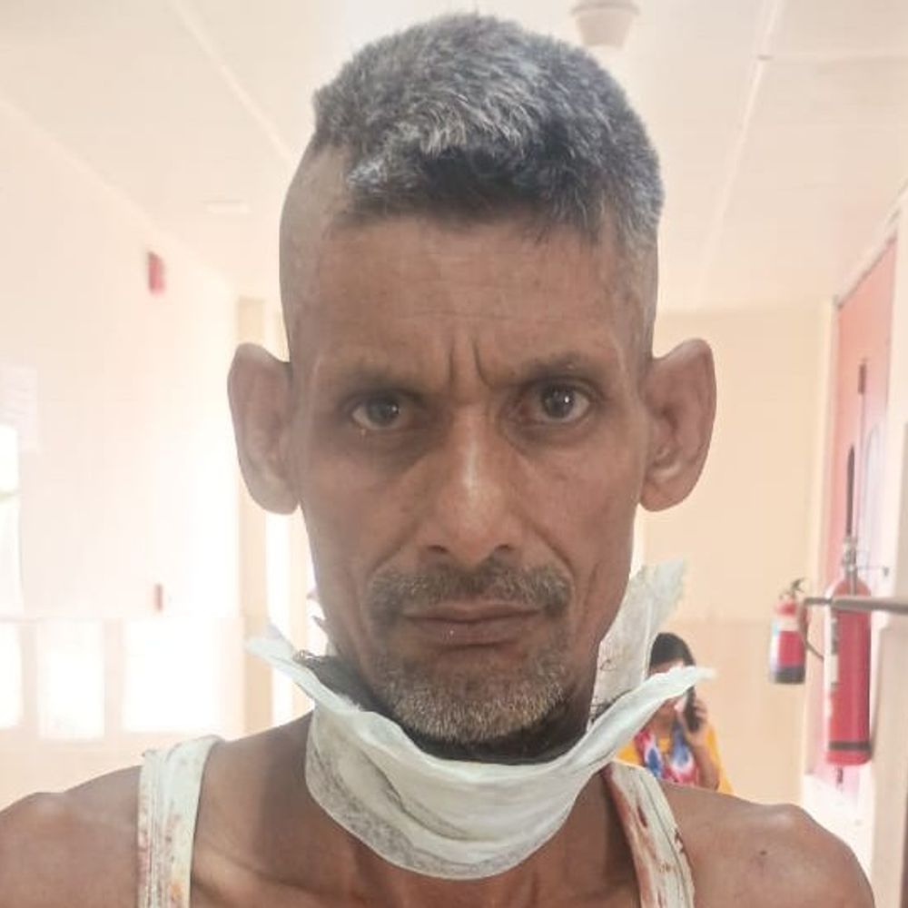 नाई ने ग्राहक पर उस्तरे से हमला किया:गर्दन और कंधे पर आई गंभीर चोट, मेडिकल कॉलेज रेफर किया गया