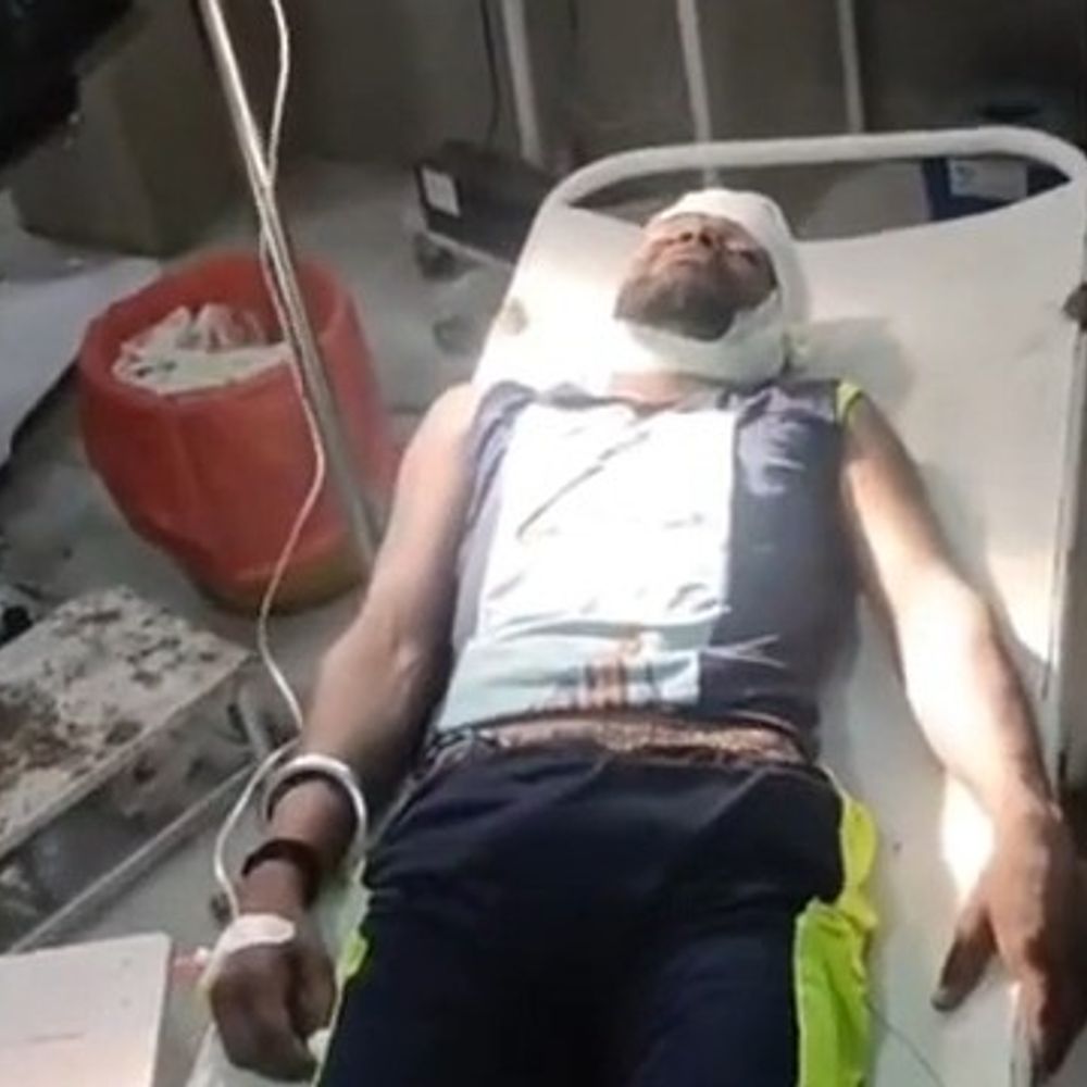 शाजापुर में वाटर पार्क हादसे में घायल युवक की मौत:इंदौर में इलाज के दौरान गई जान, पुलिस ने दी समझाइश