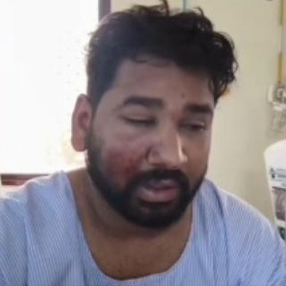 कोरबा में बोलेरो सवारों ने युवक को कुचला:पीछा करने पर साथी से मारपीट कर लूट, दो युवक गंभीर, पुलिस जांच में जुटी