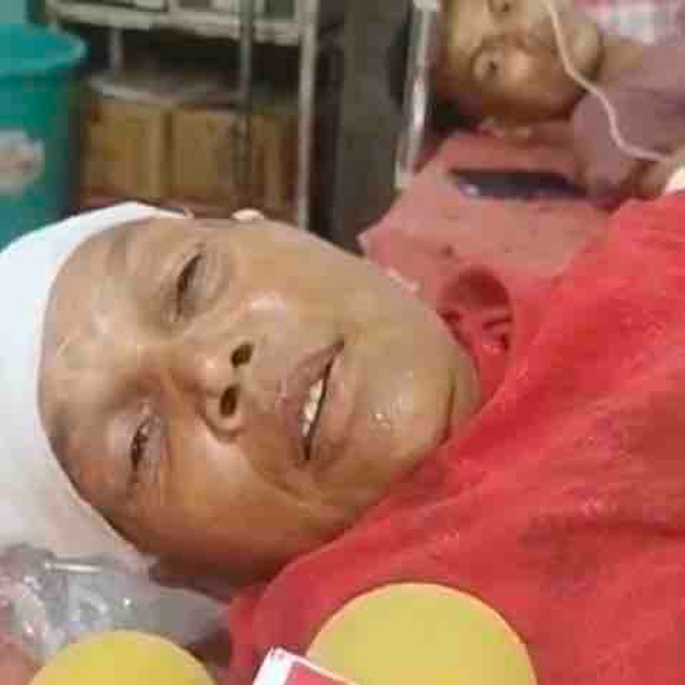 मोतिहारी में जमीन विवाद में हिंसक झड़प:महिला का हाथ कटा, दो भाइयों पर भी धारदार हथियार से हमला; तीनों घायलों की हालत गंभीर