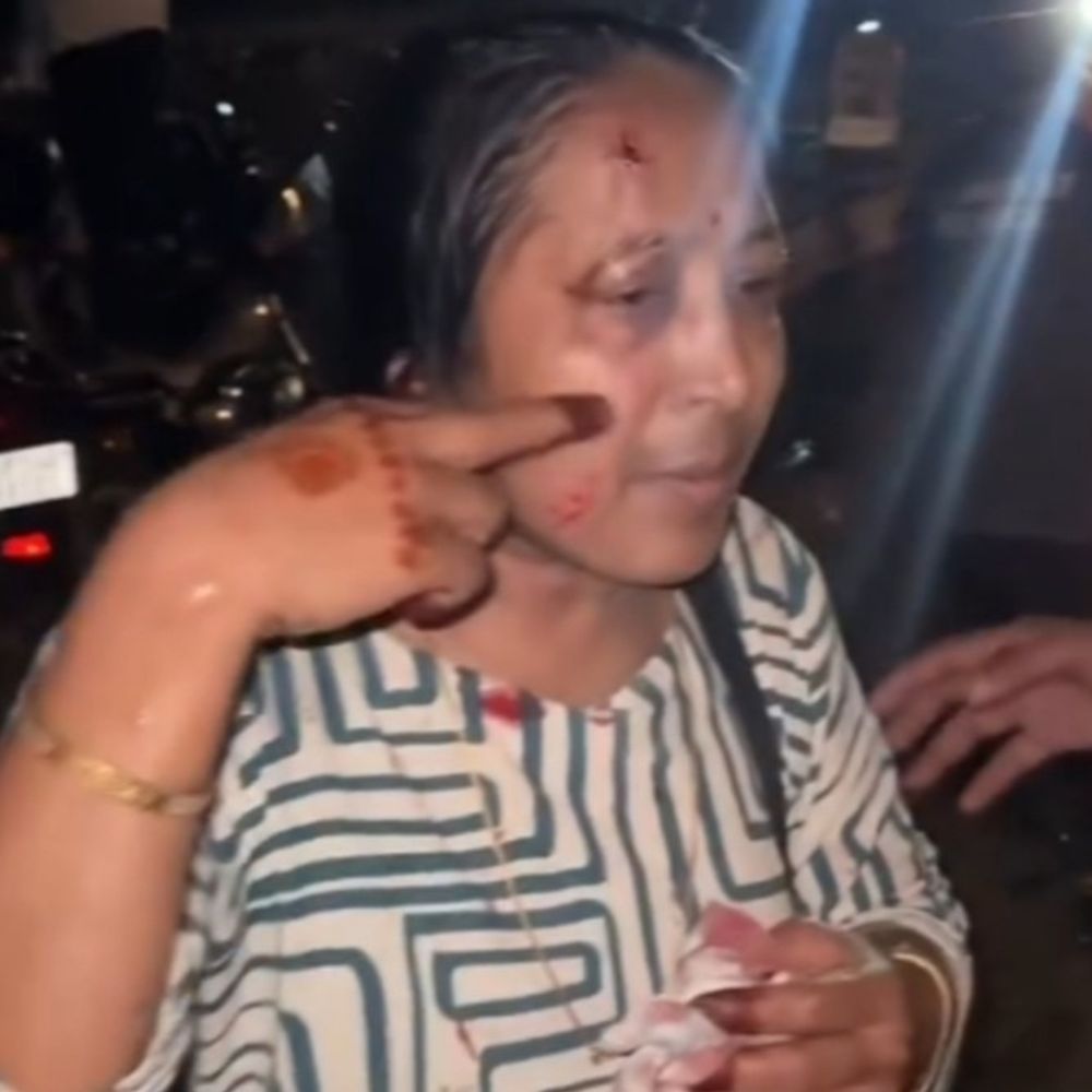 मथुरा में जैत-कट पर बस और ट्रक की जोरदार भिड़ंत:21 यात्री घायल, क्रेन से निकाले गए क्षतिग्रस्त वाहन; 35 लोग सवार थे