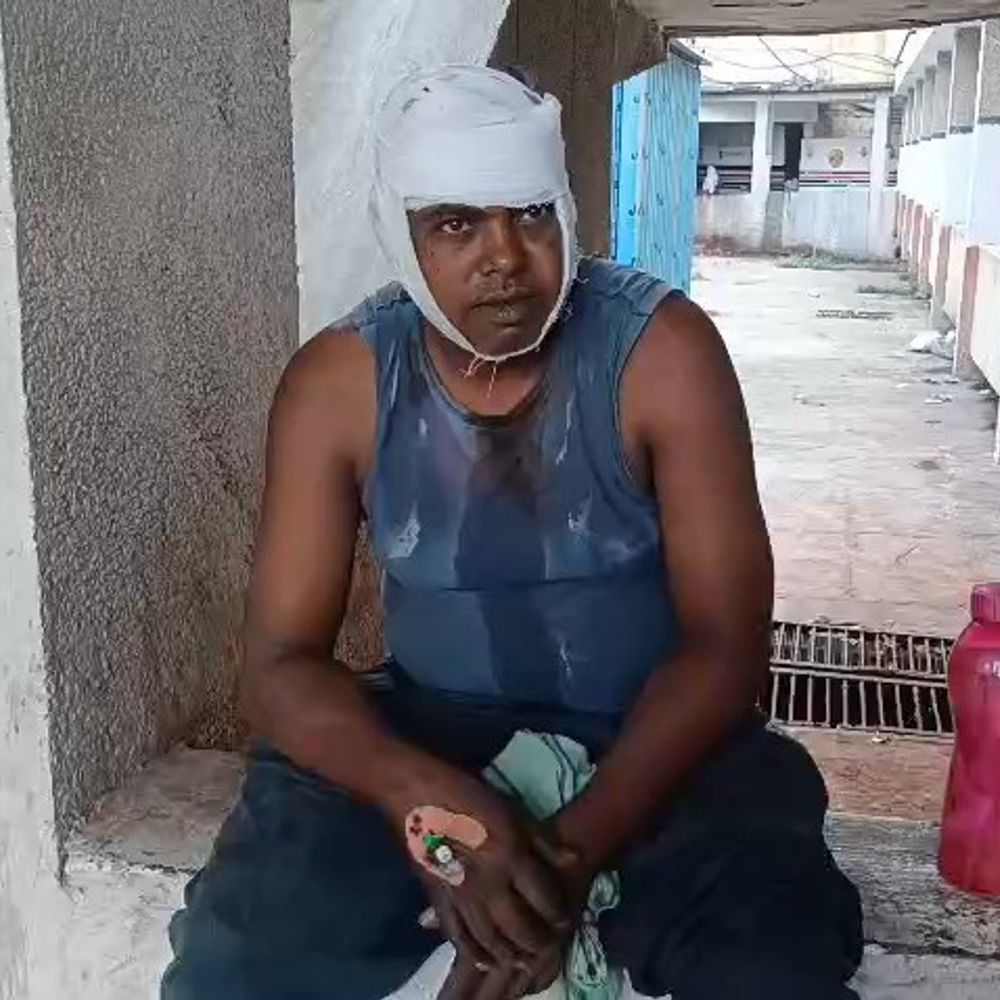 मऊगंज में जमीनी विवाद:चाचा ने भतीजे के सिर पर टांगी से हमला किया, रीवा रेफर
