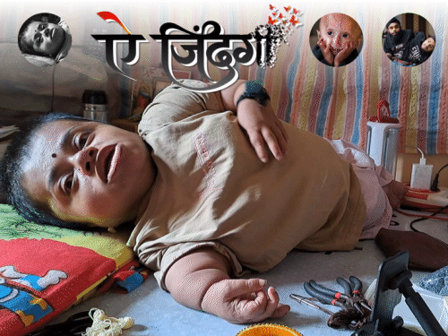 उम्र-29, हाइट 3 फीट, खांसने से टूटती हैं हड्डियां:भगवान से हर रोज कहती हूं-मुझसे पहले मेरी बेटी को उठा लेना
