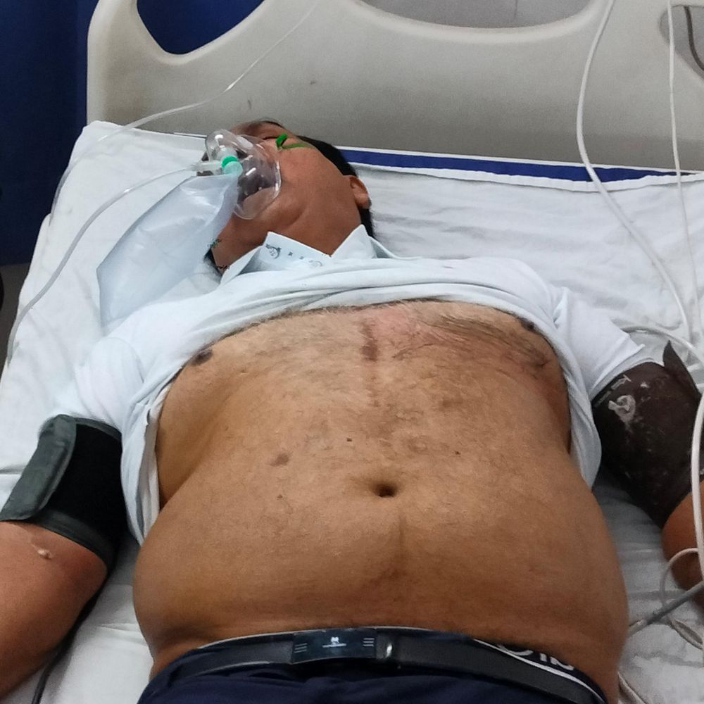 बहराइच में प्रबुद्धजन सम्मेलन में व्यापारी को हार्ट अटैक:मंत्री की अध्यक्षता में कार्यक्रम, प्राथमिक इलाज के बाद लखनऊ रेफर