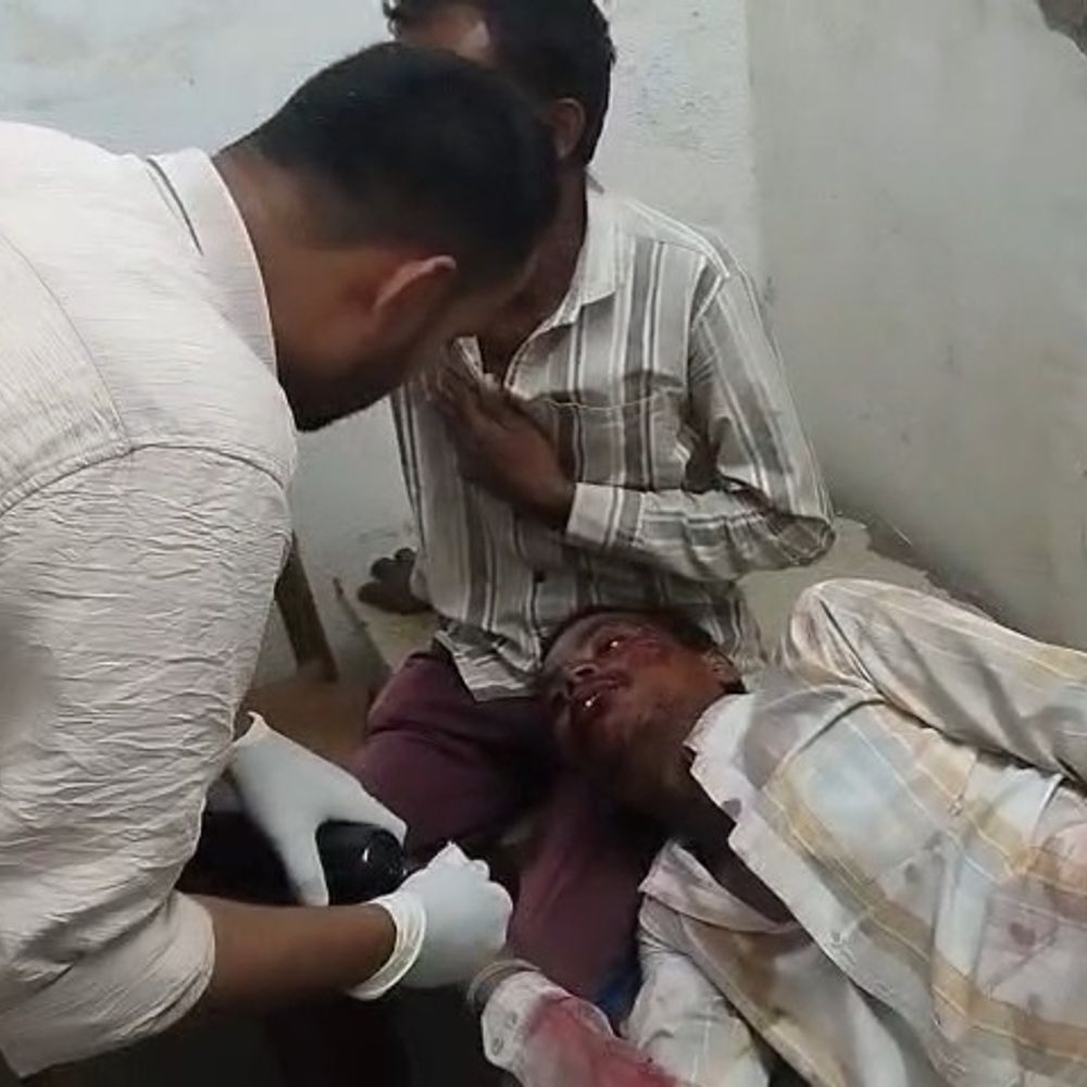 तेज रफ्तार बाइक आमने-सामने भिड़ी, 4 गंभीर घायल:मोटरसाइकिलों के परखच्चे उड़े, एक का पैर टूटा, 2 के सिर में चोट