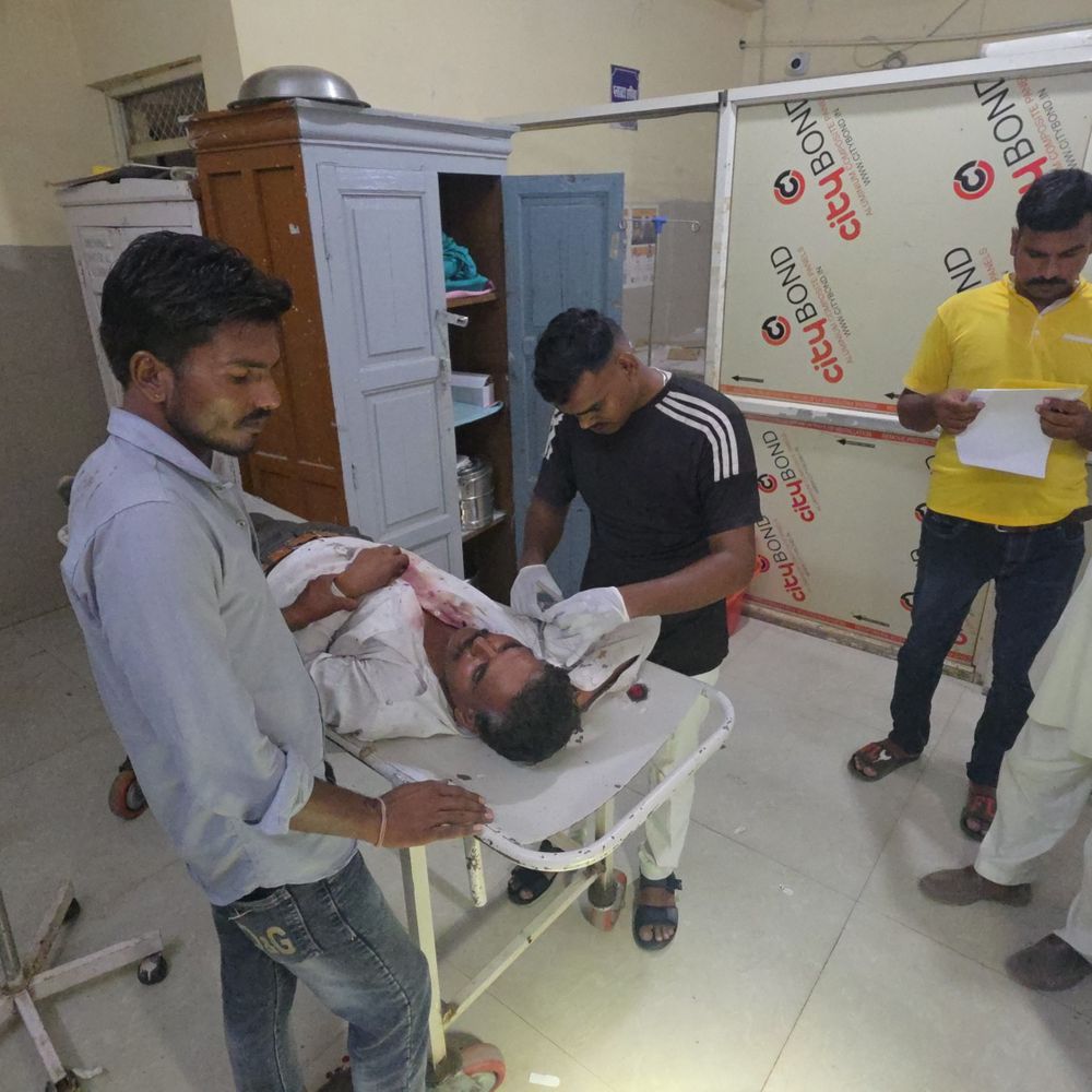 शाजापुर- सकतखेड़ी में भैंस बांधने पर दो भाइयों में विवाद:बड़ा भाई फेंककर मारा पत्थर, छोटे का फूट गया सिर