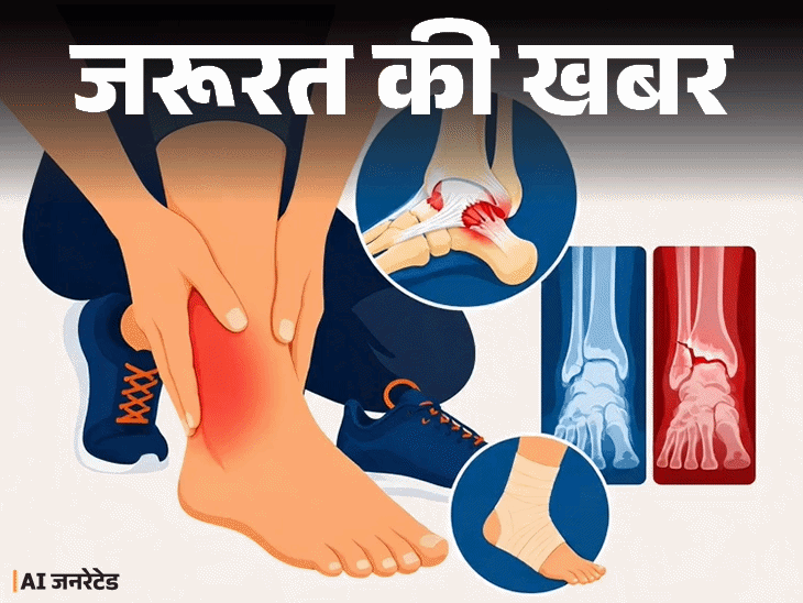 जरूरत की खबर- पैर में मोच आए तो क्या करें:फॉलो करें RICE थेरेपी, ये 7 संकेत दिखें तो डॉक्टर के पास जाएं, ये 5 गलतियां न करें