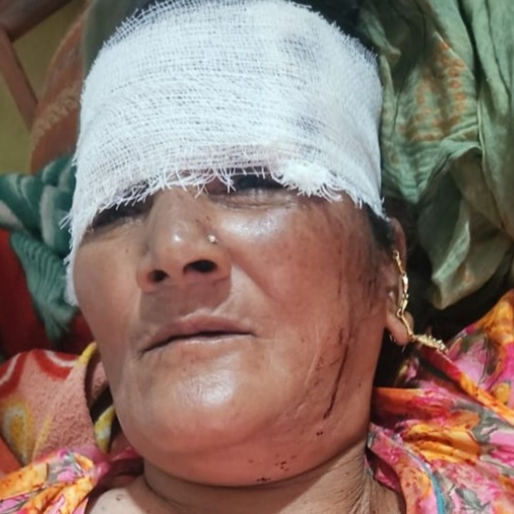 घर के बाहर सो रहे बुजुर्ग-दंपती पर पत्थर बरसाए:वृद्ध महिला का सिर फटा, 9 टांके लगाने पड़े