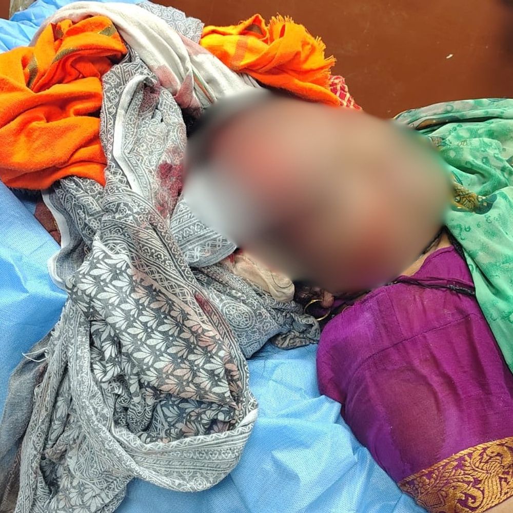 कन्नौज में छत से गिरकर महिला की मौत:खुले जाल में पैर फंसने से सिर में धंसी सरिया, अस्पताल में इलाज के दौरान मौत