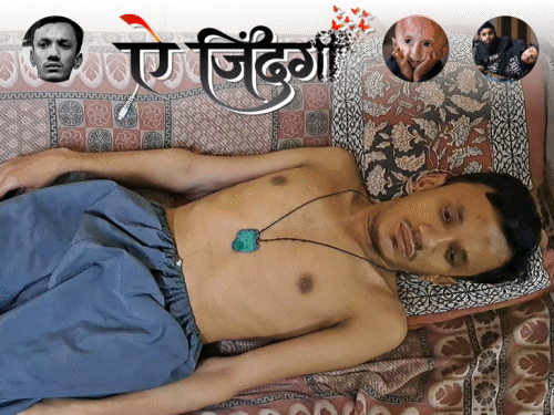 खाला की बेटी से शादी, नतीजा- बेटे को जेनेटिक बीमारी:सभी हड्डियां टेढ़ी हुईं, इलाज में हर साल 4 करोड़ का खर्च