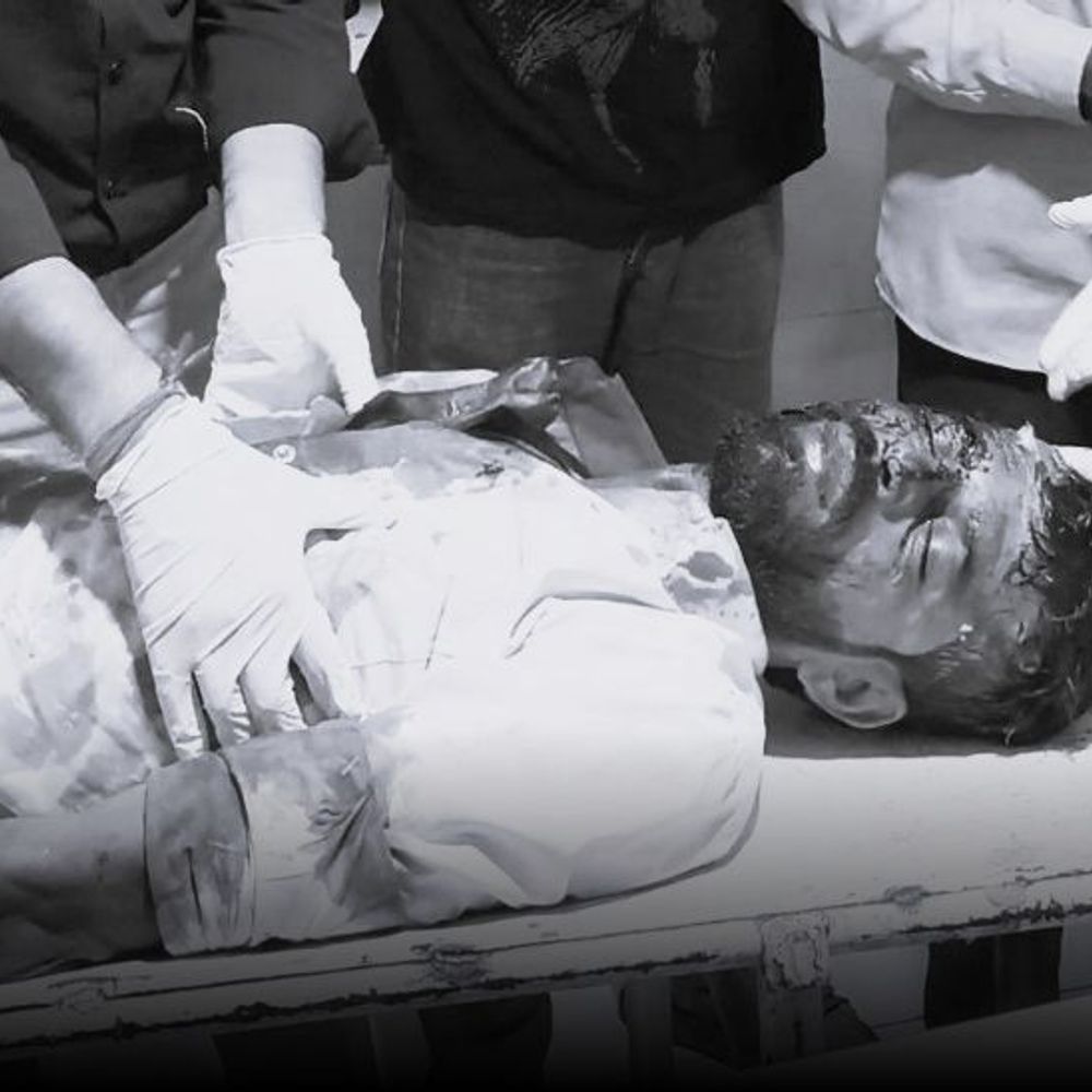देवास में जमीन विवाद में खूनी संघर्ष, तीन गंभीर:देवगुराड़िया में खेत बखरने के दौरान हुआ मामला, डंडों और हथियारों से किया था हमला