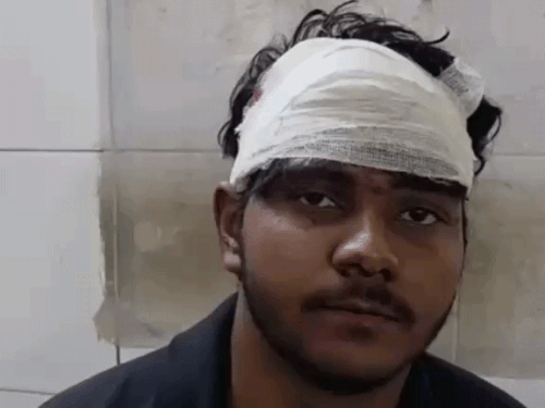 कारपेंटर ने मकान मालिक पर हाथ उठाया:दादा को बचाने आए पौता का सिर फोड़ दिया, पैसे के लेन-देन का झगड़ा