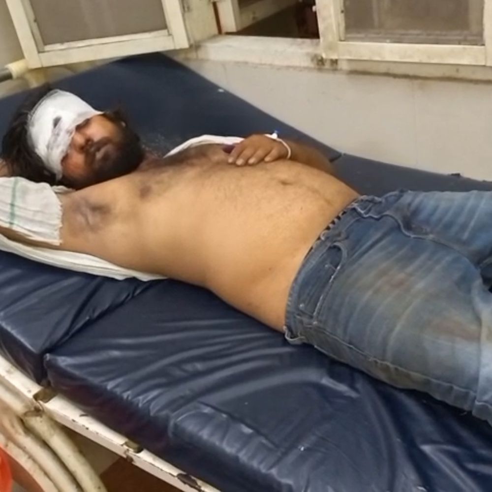 सिगरेट के धुएं पर विवाद, युवक पर सरिया से हमला:फिरोजाबाद में एक आंख में लगी गंभीर चोट, आरोपियों की तलाश जारी