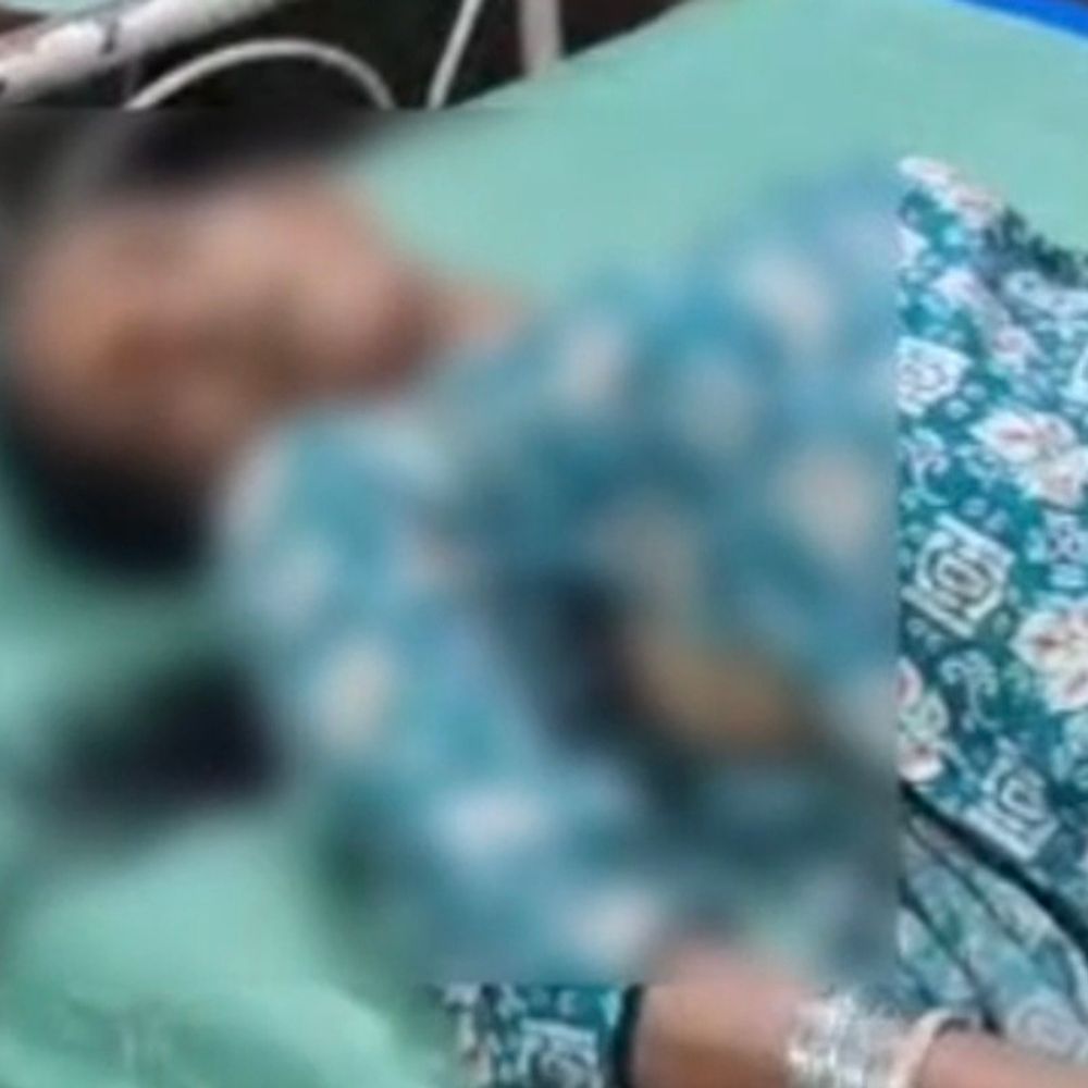 आगरा-मुरादाबाद हाईवे पर सड़क हादसे में महिला की मौत:संभल में मूसलाधार बारिश में ट्रैक्टर-ट्राली ने पीछे से बाइक को टक्कर मारी