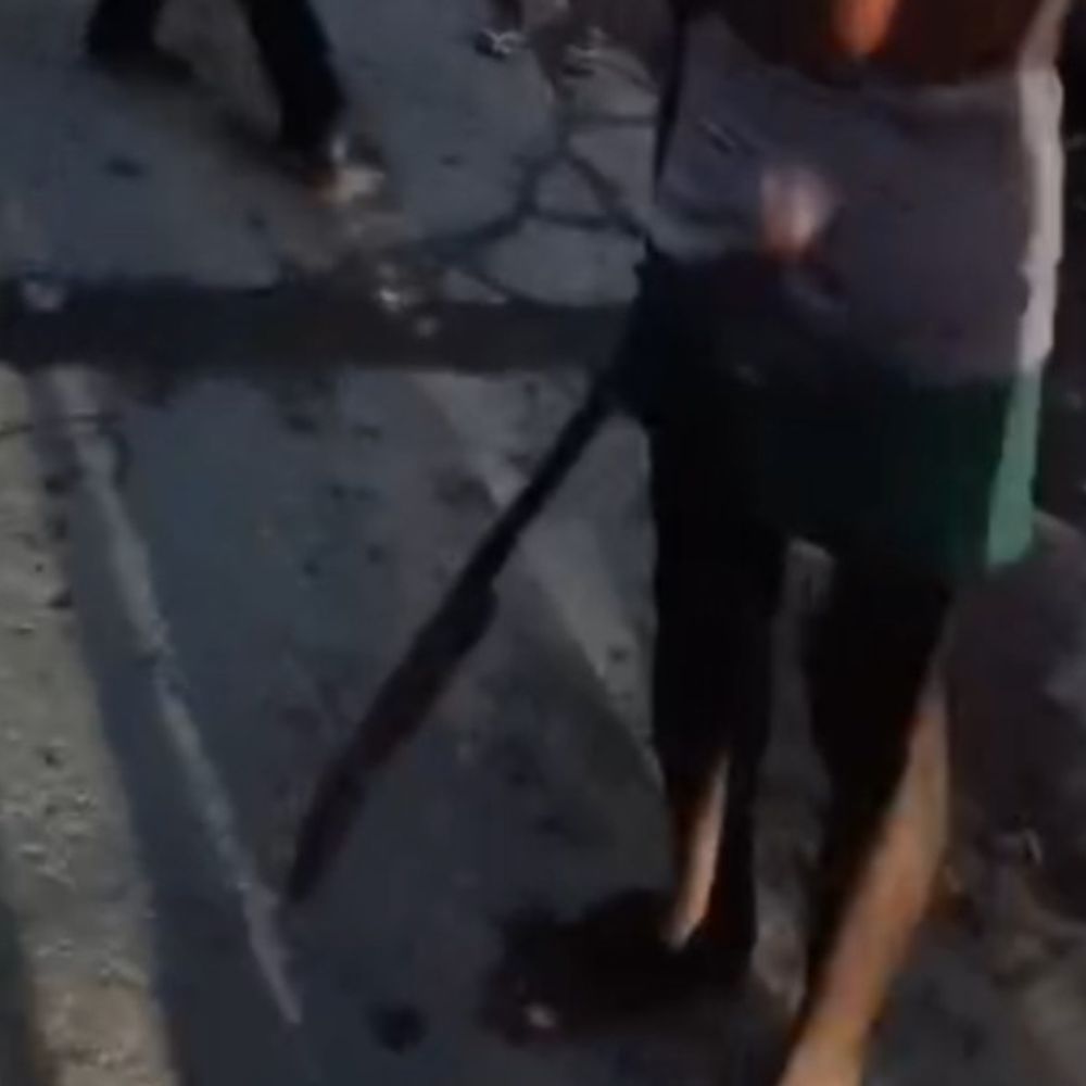 ब्रासबैंड संचालक पर तलवार से हमला करने का आरोप:हरदोई में ASP ने वीडियो का संज्ञान लिया, जांच के निर्देश दिए