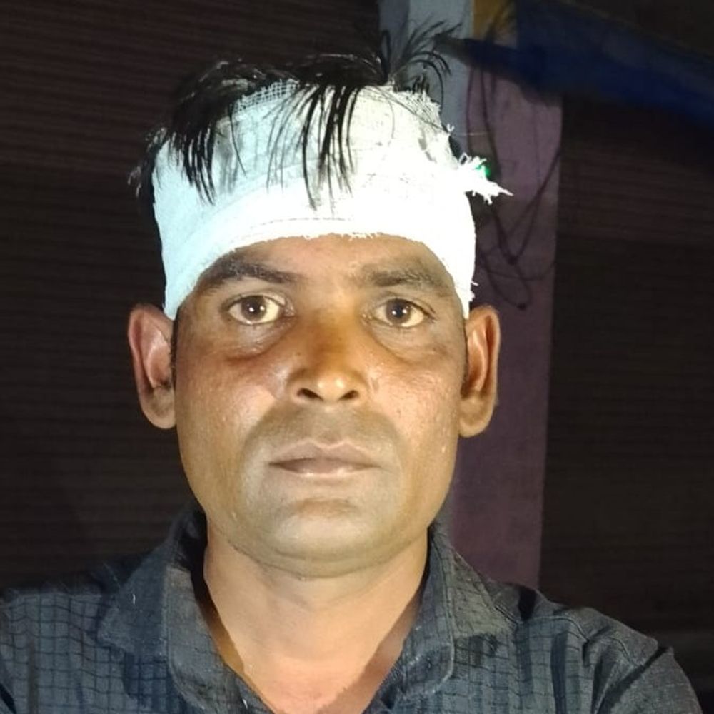 पीलीभीत में संविदा कर्मी को पीटा:फोन न उठाने पर लाठी-रॉड से हमला, गंभीर रूप से घायल