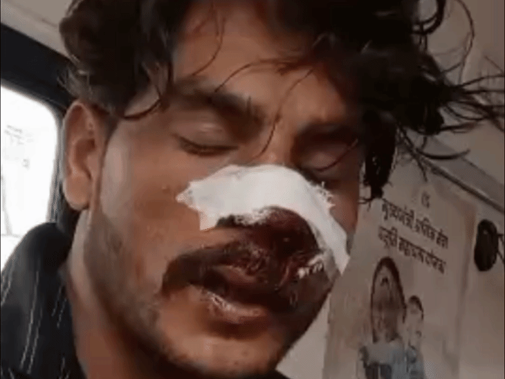 सीहोर में इंस्टाग्राम हैकिंग के शक में युवक की पिटाई:आरोप से इनकार पर लाठी-डंडों से हमला; केस दर्ज