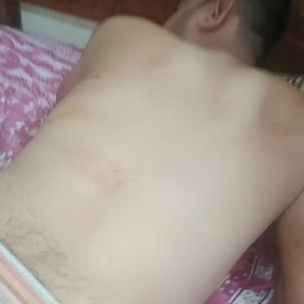 पन्ना में वन रक्षक पर हमला, वर्दी फाड़ी:काम के भुगतान विवाद में तीन भाइयों ने लाठियों से पीटा; ग्रामीणों ने बचाई जान