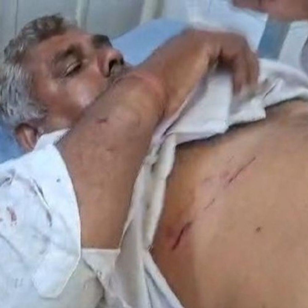 https://images.bhaskarassets.com/thumb/1000x1000/web2images/521/2026/07/18/01_1784352288.jpeg