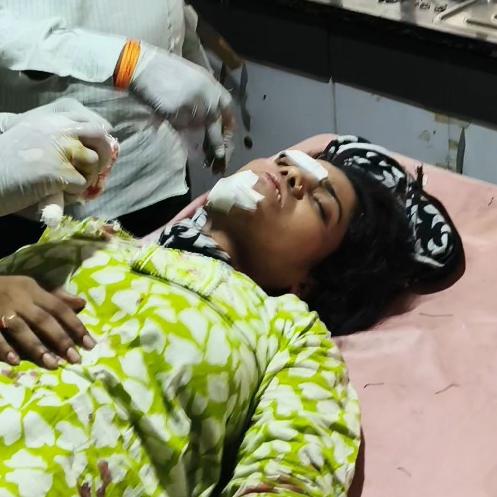 
                 वाहन ने कॉलेज से घर जाती छात्राओं को टक्कर मारी:देवास में एक का पैर फ्रैक्चर, दूसरी को भी चोट; इंदौर किया रेफर 
            