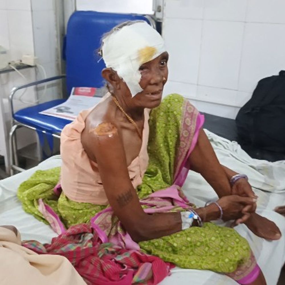 
                 बराछ मोड़ पर हादसा, वृद्ध महिला गंभीर घायल:20 फीट तक घिसटती रहीं, बाइक के सामने आ गया था कुत्ता 
            