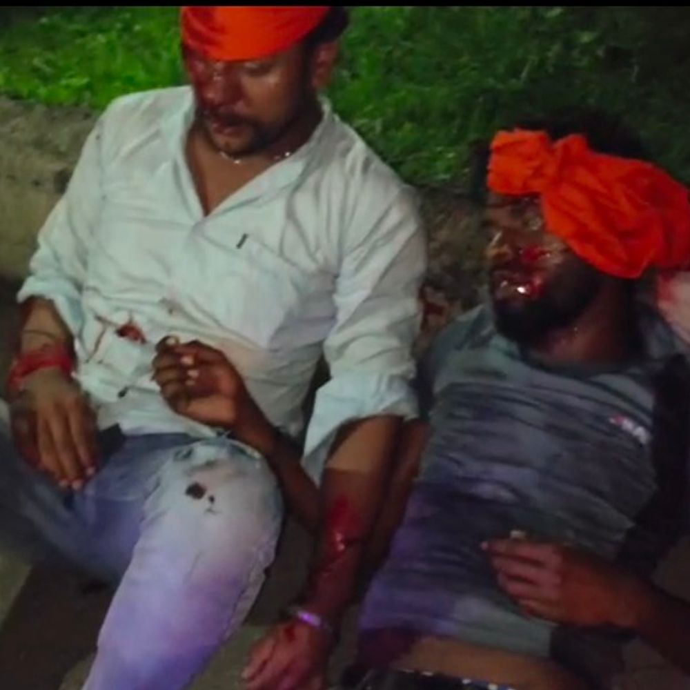 
                 सीधी में दो बाइक की भिड़ंत, दो युवक घायल:दोनों के चेहरे-सिर में चोटें, जिला अस्पताल में भर्ती कराया 
            