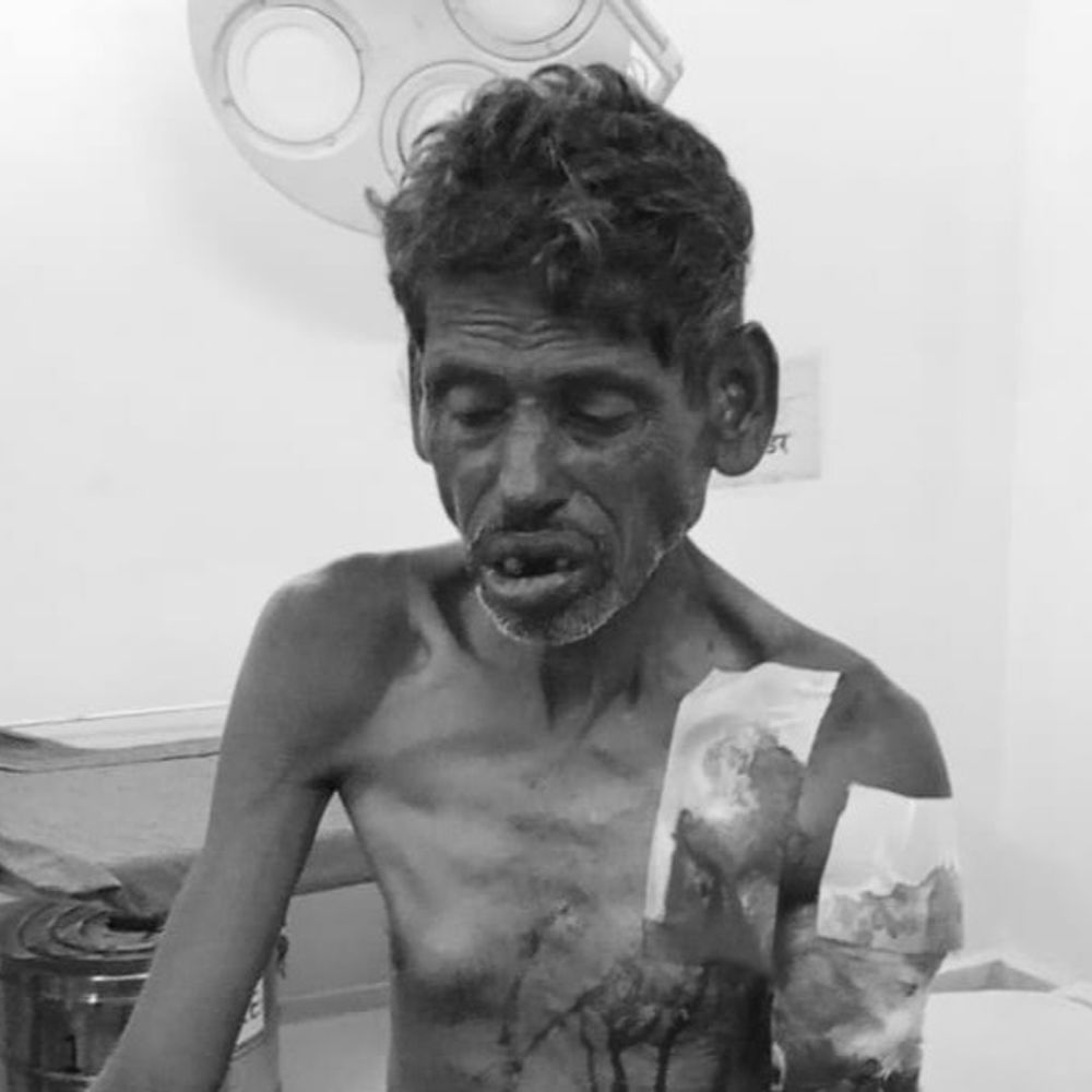 
                 चरवाहे पर तेंदुए का हमला:पन्ना में जंगल में भैंस चराते समय हादसा हुआ, हाथ जख्मी; कटनी मेडिकल कॉलेज रेफर 
            