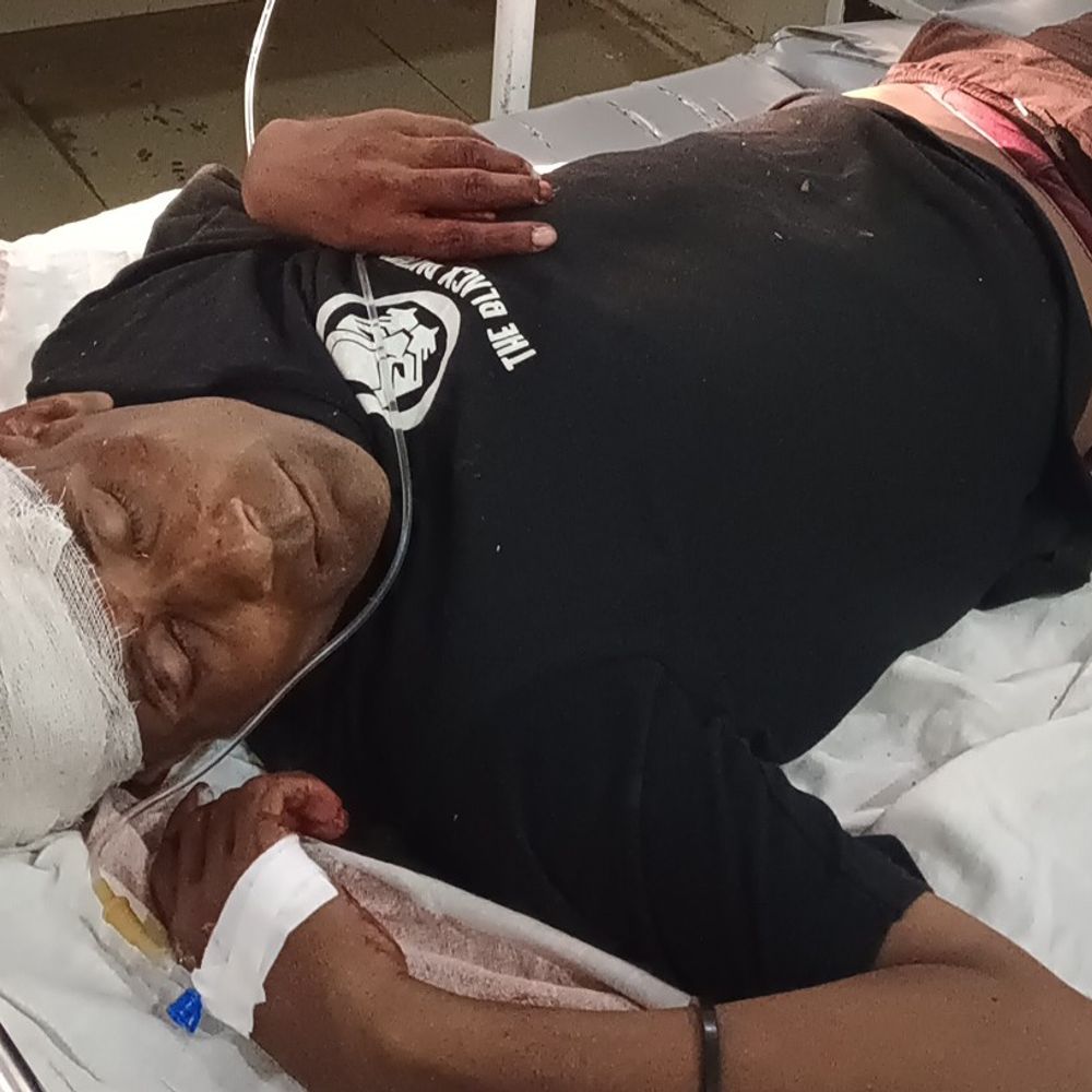 बरवाखुर्द में अज्ञात वाहन की टक्कर से बाइक सवार घायल:गोरखपुर बीआरडी मेडिकल कॉलेज रेफर किया गया