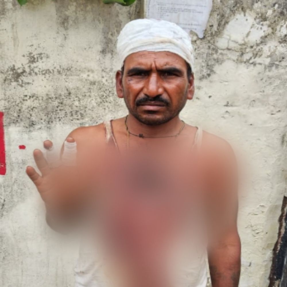 जयपुर में RTO दस्ते ने ट्रक ऑनर का सिर फोड़ा:खून से लथपथ छोड़कर भागे, मोबाइल तोड़ा; 50 हजार का चालान भरने पर कहासुनी
