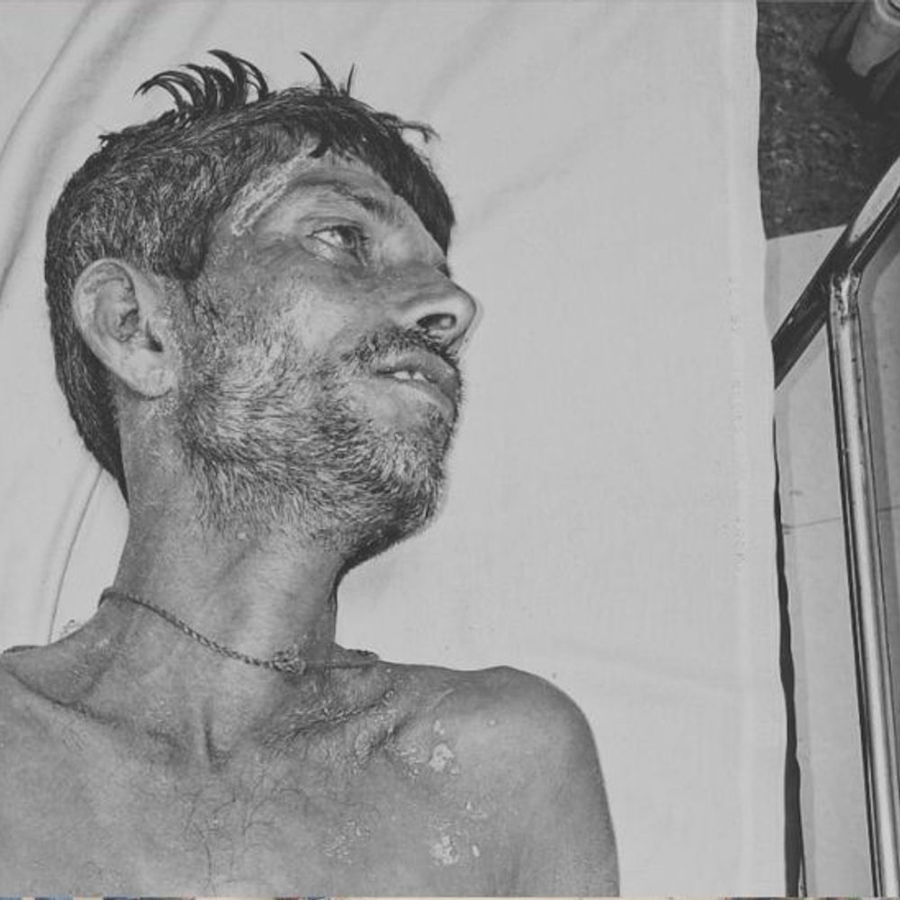 पटना में करंट लगने से किसान की मौत:खेत में काम करते समय चपेट में आया, पुलिस ने शव पोस्टमॉर्टम के लिए भेजा