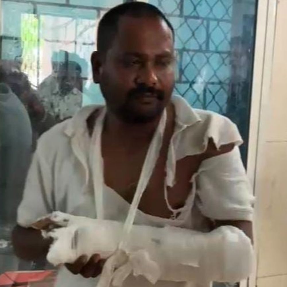 
                 अवैध रूप खनन रोकने पर आलोट में पटवारी पर हमला:जेसीबी को थाने ले जाने पर मारपीट की, पंचनामा फाड़ा; हाथ में हुआ फैक्चर 
            