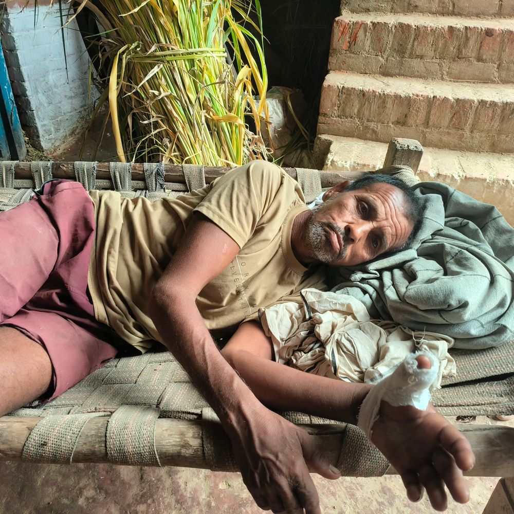 15 दिन में 75 लोगों को कुत्तों ने काटा:कानपुर के भीतरगांव में आवारा कुत्तों का आतंक, दो बच्चों की हालत गंभीर