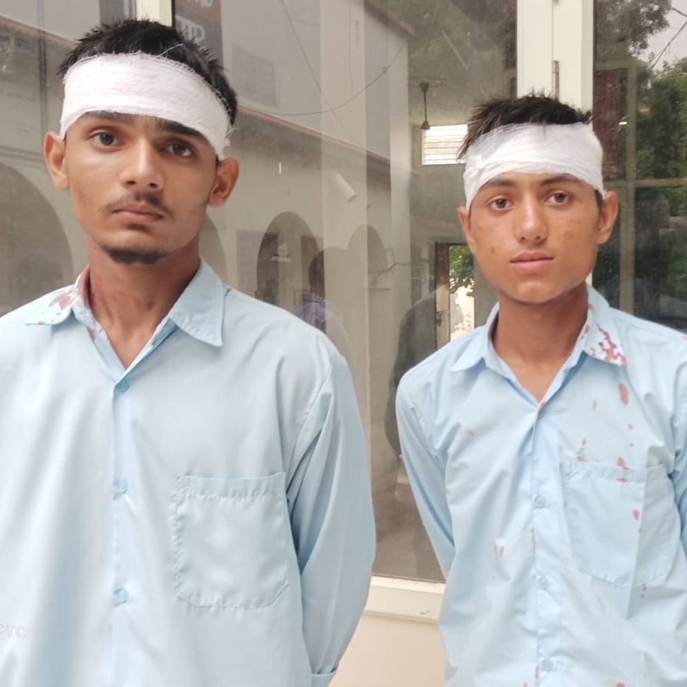 शामली में छात्रों के दो गुटों में खूनी संघर्ष:धारदार हथियार से हमले में दो घायल, पुलिस पर लापरवाही का आरोप लगाया