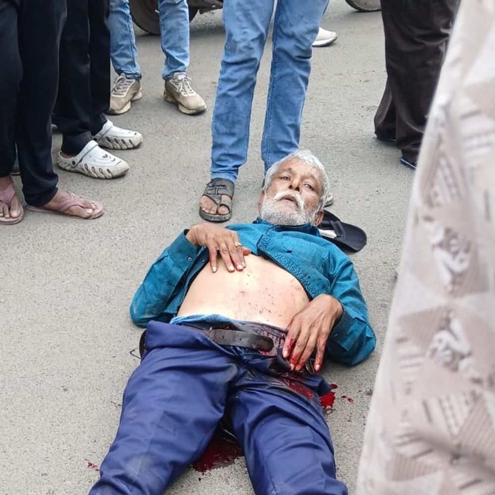 
                 उज्जैन में दिनदहाड़े बुजुर्ग को गोली मारी:शहर के फ्रीगंज क्षेत्र में अफरा तफरी मची, बुजुर्ग को अस्पताल ले जाया गया 
            