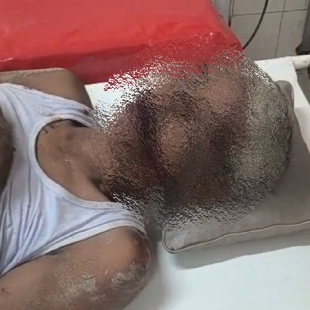 उन्नाव में युवक पर लाठी से ताबड़तोड़ हमला:CCTV में कैद हुई वारदात, स्कूटी से घर लौटते समय रास्ते में रोकास मारपीट का आरोप; आरोपी फरार
