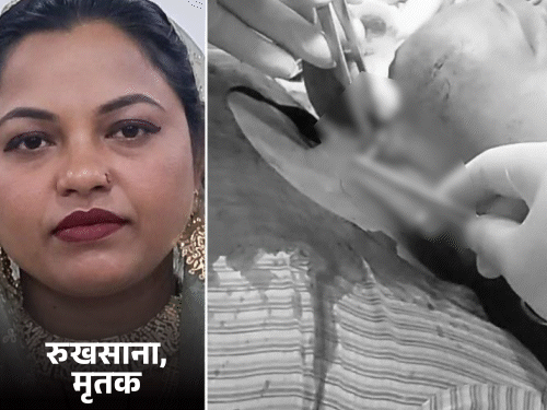महिला ने चाकू से खुद का गला काटा:कानपुर में ससुराल वालों से थी परेशान, खून से लथपथ तड़पती रही, 20 घंटे बाद मौत