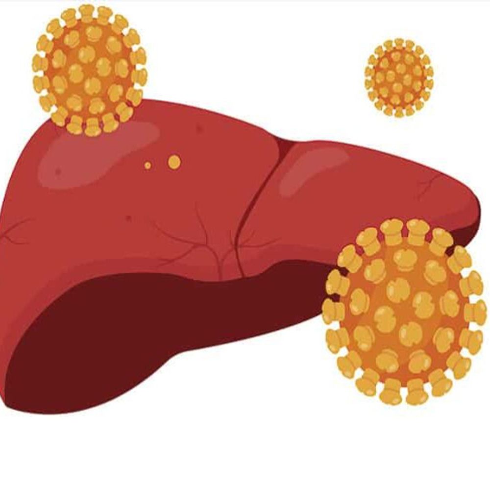 
                 विश्व हेपेटाइटिस दिवस आज:साइलेंट किलर बना हेपेटाइटिस-बी : 80% मरीजों में लक्षण ही नहीं 
            