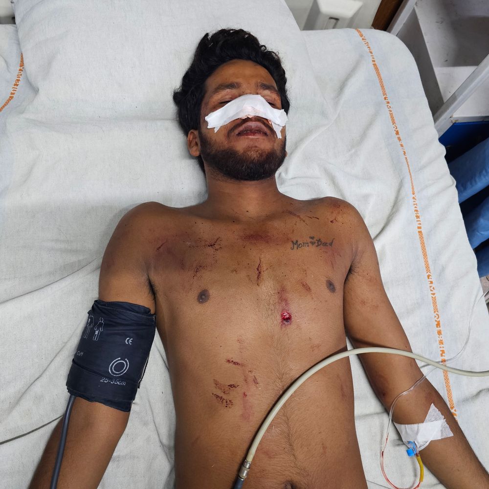 
                 अज्ञात वाहन ने बाइक को टक्कर मारी, युवक गंभीर घायल:मंदसौर की ढाबला चौपाटी पर हादसा, पिता-पुत्र किराना लेकर लौट रहे थे घर 
            