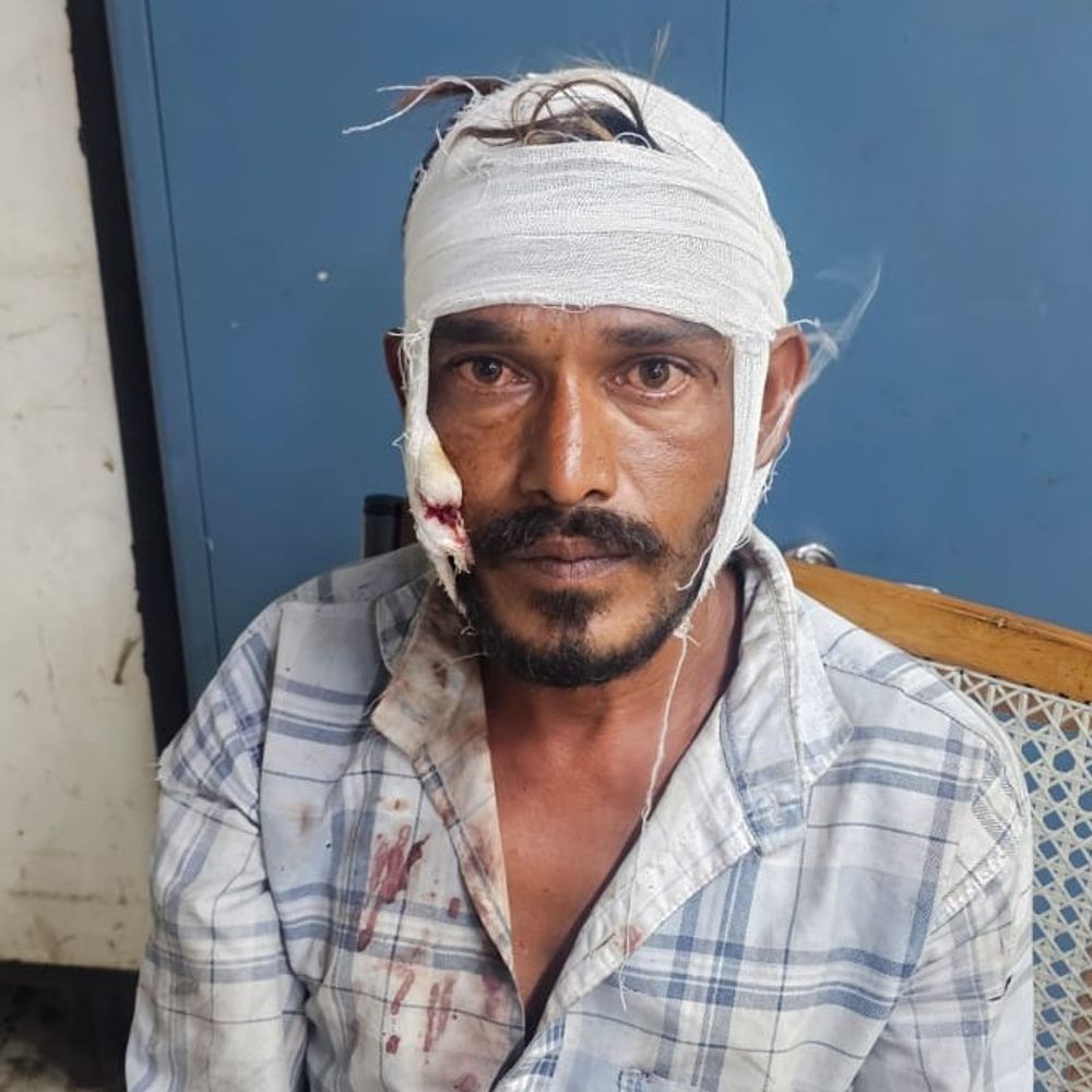 
                 टीवी का चैनल बदलने पर पति-पत्नी में विवाद:पत्नी ने हंसिए से किया वार, पति घायल, छोला मंदिर इलाके की घटना 
            