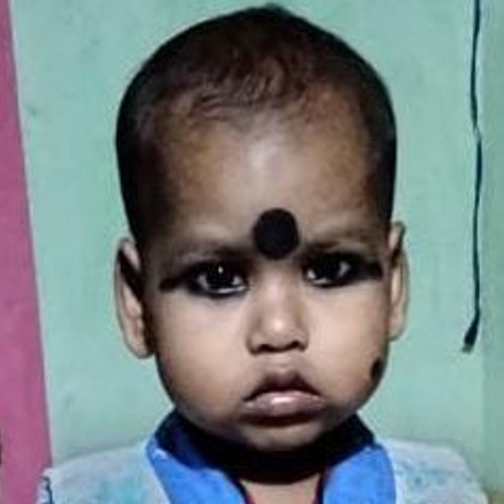 दीवार गिरने से 4 साल के बच्चे की मौत:बांका में मां-भाई घायल; लगातार बारिश से कमजोर होकर ढही मिट्टी की दीवार