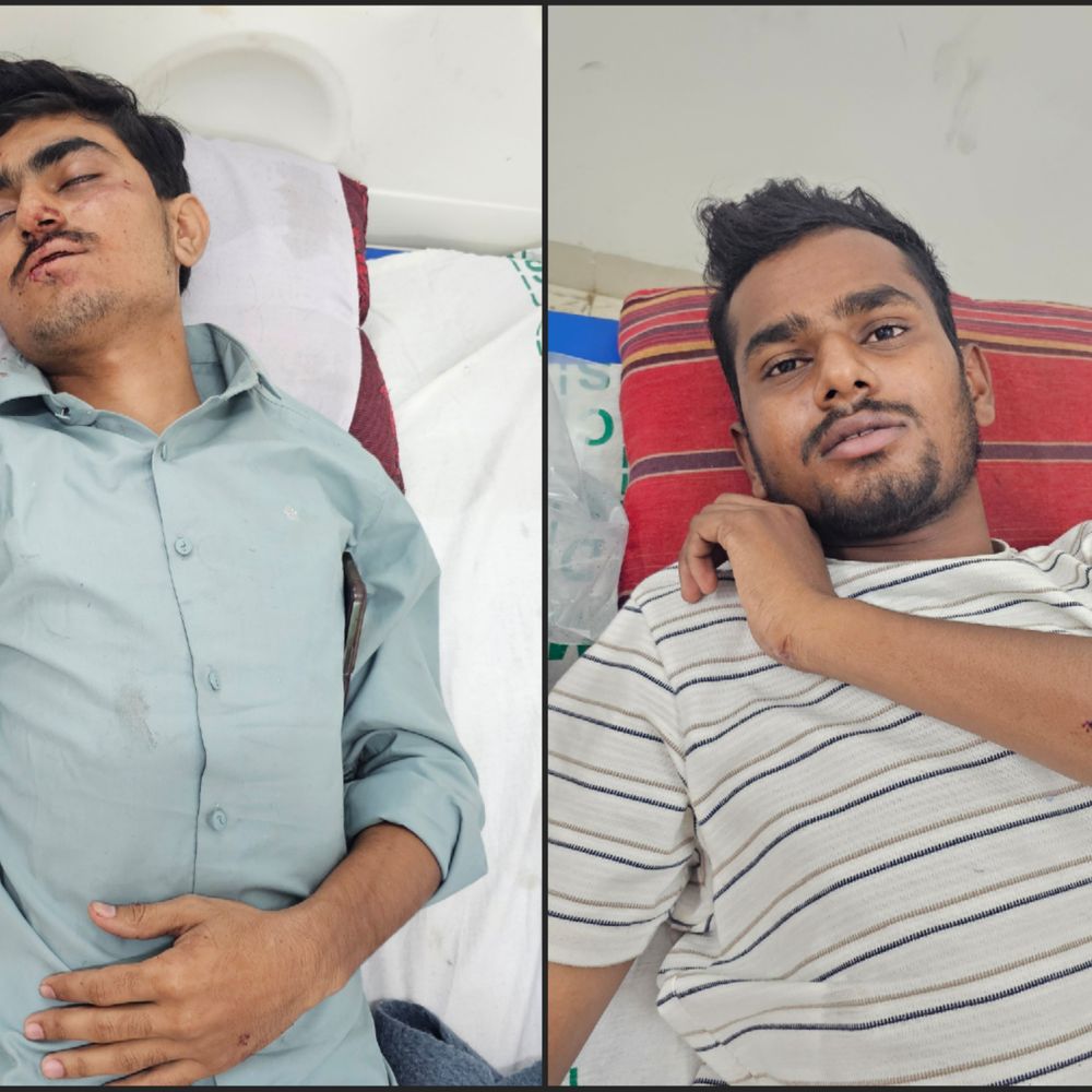 
                 कार ने मेडिकल छात्रों की बाइक को मारी टक्कर:दोनों के पैरों में फ्रैक्चर, गंभीर हालत में मंदसौर से इंदौर रेफर; ड्राइवर फरार 
            