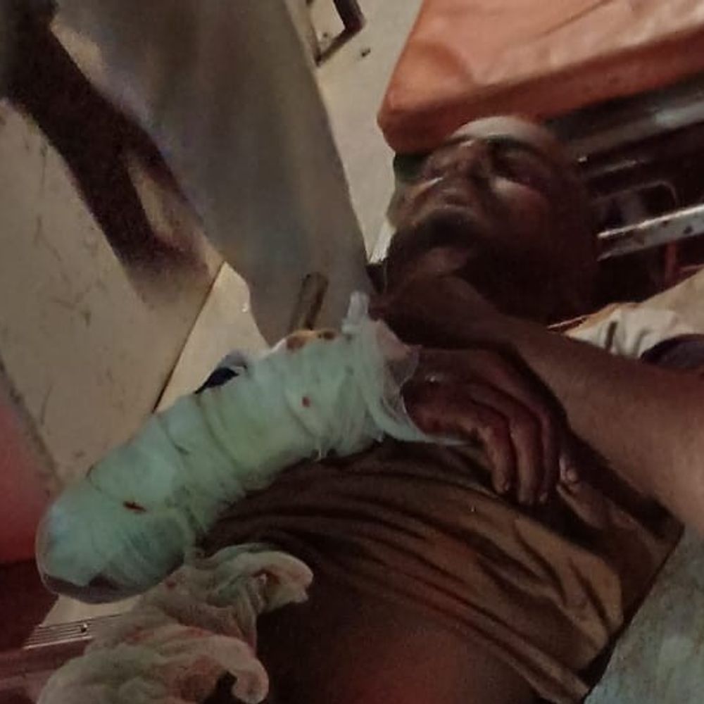 गोंडा में जमीनी विवाद पर मारपीट और फायरिंग:VHP संयोजक समेत 6 पर केस दर्ज, 3 गंभीर घायल लखनऊ रेफर