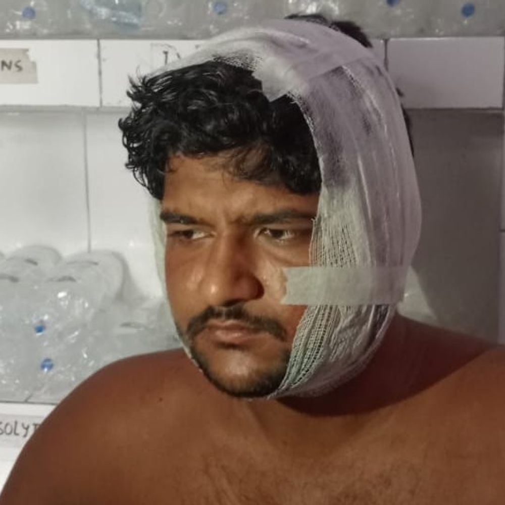मुरादाबाद में फिर एक युवक पर तेंदुओं का हमला:तड़के 4 बजे एक तेंदुआ पिंजड़े में फंसा; 11:30 बजे 3 तेंदुओं का फिर अटैक